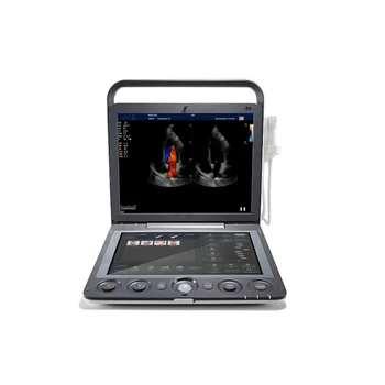 Оборудование для визуализации Портативный мобильный ультразвуковой аппарат Проводник иглы 4d ультразвук сердца